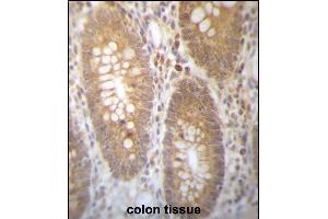 DHRS7B Antibody (Center) (ABIN657263 and ABIN2846358) immunohistochemistry analysis in formalin fixed and paraffin embedded human colon tissue followed by peroxidase conjugation of the secondary antibody and DAB staining. (DHRS7B Antikörper  (AA 133-161))