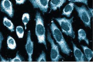Immunofluorescence staining of human endothelial cells. (EIF2AK2 Antikörper  (AA 117-250))