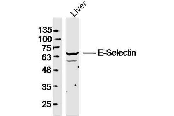 Selectin E/CD62e Antikörper  (AA 501-612)