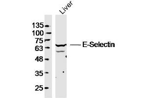 Mouse liver lysates probed with E-selectin Polyclonal Antibody, unconjugated  at 1:300 overnight at 4°C followed by a conjugated secondary antibody at 1:10000 for 90 minutes at 37°C. (Selectin E/CD62e Antikörper  (AA 501-612))