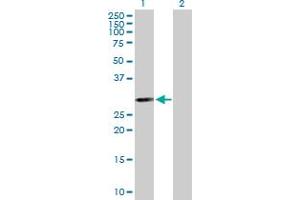 Western Blot analysis of PSMB5 expression in transfected 293T cell line by PSMB5 MaxPab polyclonal antibody.