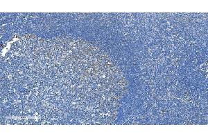 IHC analysis of DRP1/DNM1L using anti-DRP1/DNM1L antibody (ABIN7602180). (Dynamin 1-Like Antikörper  (AA 618-736))