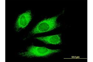 Immunofluorescence of monoclonal antibody to TG on HeLa cell. (Thyroglobulin Antikörper  (AA 2659-2768))