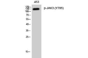 Western Blot analysis of 453 cells with Phospho-JAK3 (Tyr785) Polyclonal Antibody at dilution of 1:1000 (JAK3 Antikörper  (pTyr785))