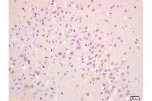 Immunohistochemistry (IHC) image for anti-Guanine Nucleotide Binding Protein (G Protein), Q Polypeptide (GNAQ) (AA 51-150) antibody (ABIN763181)