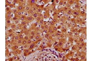 IHC image of ABIN7164796 diluted at 1:400 and staining in paraffin-embedded human liver tissue performed on a Leica BondTM system.