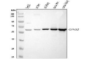 Western blot analysis of EPHX2 using anti-EPHX2 antibody (ABIN4886572). (EPHX2 Antikörper  (C-Term))