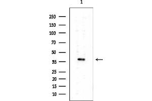 Western blot analysis of lysates from EC304 cells, using SLC39A1 Mouse Monoclonal Antibody at 1/1000 dilution.