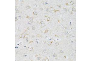 Immunohistochemistry of paraffin-embedded rat brain using SLC2A13 antibody. (SLC2A13 Antikörper  (AA 564-648))