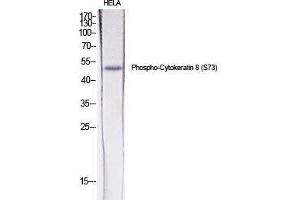 Western Blot (WB) analysis of specific cells using Phospho-Cytokeratin 8 (S73) Polyclonal Antibody.