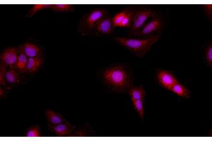 Immunofluorescence (IF) image for anti-Breast Cancer 2, Early Onset (BRCA2) antibody (ABIN7234156)