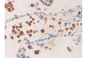 IHC-P analysis of Human Lung Tissue, with DAB staining. (PLA1A Antikörper  (AA 309-452))