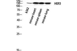 Western Blot (WB) analysis of k562 Mouse Heart Mouse Spleen Mouse Lung cells using ErbB-3 Polyclonal Antibody. (ERBB3 Antikörper  (N-Term))