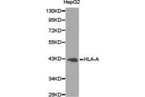 Western Blotting (WB) image for anti-Major Histocompatibility Complex, Class I, A (HLA-A) antibody (ABIN1873024)