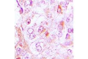 Immunohistochemistry (IHC) image for anti-Collagen, Type VI, alpha 2 (COL6A2) (Center) antibody (ABIN7295328)