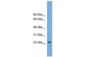 Western Blot showing RAB15 antibody used at a concentration of 1-2 ug/ml to detect its target protein. (RAB15 Antikörper  (Middle Region))