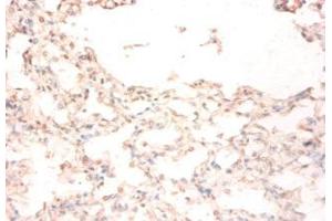 Immunohistochemistry of paraffin-embedded human lung tissue using ABIN7159501 at dilution of 1:50 (STEAP1 Antikörper  (AA 3-69))