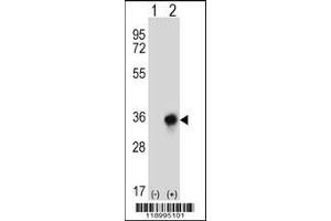 Western blot analysis of CBR3 using rabbit polyclonal CBR3 Antibody using 293 cell lysates (2 ug/lane) either nontransfected (Lane 1) or transiently transfected (Lane 2) with the CBR3 gene. (CBR3 Antikörper  (C-Term))