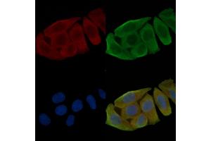ABIN6256734 and ABIN6267559 staining Hela cells(30 min of UV treatment) by IF/ICC.