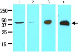 Cell lysates of HeLa (lane 1), MCF-7 (lane 2), LNCaP (lane 3) and mouse brain (lane 4) (30 ug) were resolved by SDS-PAGE and probed with TREM2 monoclonal antibody, clone 2B5  (1:500). (TREM2 Antikörper  (AA 19-161))