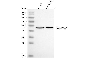 anti-StAR-Related Lipid Transfer (START) Domain Containing 3 (STARD3) (AA 3-429) antibody