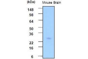 Western Blotting (WB) image for anti-Phosphoserine Phosphatase (PSPH) (AA 1-225), (N-Term) antibody (ABIN317527) (PSPH Antikörper  (N-Term))