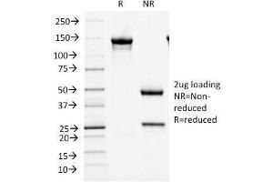 SDS-PAGE Analysis Purified MCM7 Mouse Monoclonal Antibody (MCM7/1466). (MCM7 Antikörper  (AA 195-319))