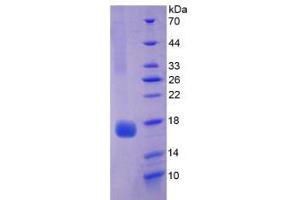 SDS-PAGE analysis of Rat Myoglobin Protein. (Myoglobin Protein (MB))