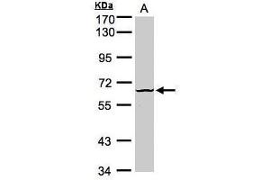 WB Image Sample (30μg whole cell lysate) A:Raji , 7. (DYRK3 Antikörper)