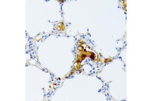 Immunohistochemistry of paraffin-embedded mouse lung using CTRB1 antibody (ABIN7266398) at dilution of 1:100 (40x lens). (CTRB1 Antikörper  (AA 79-263))