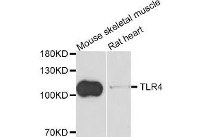 Western blot analysis of extracts of mouse skeletal muscle and rat heart cell lines, using TLR4 antibody. (TLR4 Antikörper)