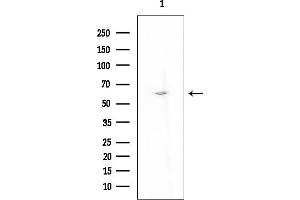 Western blot analysis of lysates from Mouse testis, using NBPF6 Antibody at 1/1000 dilution.