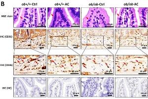 Immunohistochemistry (IHC) image for anti-CD36 (CD36) (C-Term) antibody (ABIN2854820)