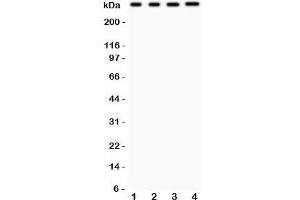 Western Blotting (WB) image for anti-Inositol 1,4,5-Trisphosphate Receptor, Type 3 (ITPR3) (AA 2411-2758) antibody (ABIN3031328)