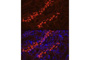 Immunofluorescence (IF) image for anti-ATPase, H+ Transporting, Lysosomal 56/58kDa, V1 Subunit B1 (ATP6V1B1) (AA 1-280) antibody (ABIN6137346)