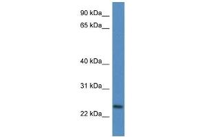 Western Blot showing CD9 antibody used at a concentration of 1 ug/ml against Fetal Heart Lysate (CD9 Antikörper  (N-Term))