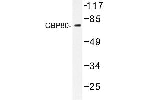 Image no. 1 for anti-Nuclear Cap Binding Protein Subunit 1, 80kDa (NCBP1) antibody (ABIN272218) (NCBP1 Antikörper)