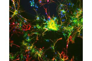Neuron-glia cell mixture cultures stained with ABIN1842243 (green) and our Rabbit polyclonal antibody against GFAP: RPCA-GFAP (red). (Aldehyde Dehydrogenase H1L1 Antikörper)