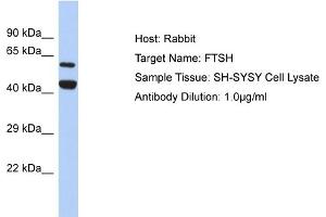 Host: Rabbit Target Name: FTSH Sample Type: SH-SYSY Whole cell lysates Antibody Dilution: 1.
