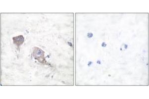 Immunohistochemistry analysis of paraffin-embedded human brain tissue, using SNAP25 Antibody. (SNAP25 Antikörper  (AA 151-200))