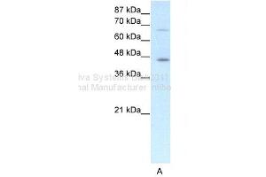 WB Suggested Anti-ESR2 Antibody Titration: 1. (ESR2 Antikörper  (N-Term))