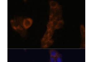 Immunofluorescence analysis of A-431 cells using RPL23A Polyclonal Antibody at dilution of 1:100.
