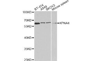 Western blot analysis of extracts of various cell lines, using KPNA4 antibody. (KPNA4 Antikörper)