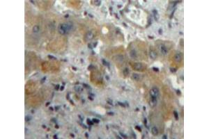 IHC-P analysis of Liver tissue, with DAB staining. (PLGF Antikörper  (AA 43-162))