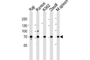 Western blot analysis of lysates from Raji, Ramos, K562, Daudi cell line and mouse spleen tissue lysate(from left to right), using BTK Antibody (Center) (ABIN6243554 and ABIN6577451). (BTK Antikörper  (AA 396-430))