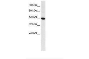 Image no. 1 for anti-Homeobox A13 (HOXA13) (AA 80-129) antibody (ABIN6735847) (HOXA13 Antikörper  (AA 80-129))