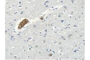 Figure. (Myosin Antikörper  (AA 1069-1331))