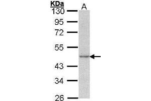 WB Image Sample (30 ug of whole cell lysate) A: A431 , 10% SDS PAGE antibody diluted at 1:1000 (Actin, gamma 1 Antikörper  (N-Term))