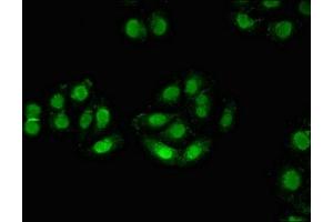 Immunofluorescent analysis of A549 cells using ABIN7176092 at dilution of 1:100 and Alexa Fluor 488-congugated AffiniPure Goat Anti-Rabbit IgG(H+L)