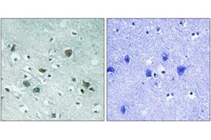 Immunohistochemistry analysis of paraffin-embedded human brain, using CRMP-2 (Phospho-Thr509) Antibody. (DPYSL2 Antikörper  (pThr509))